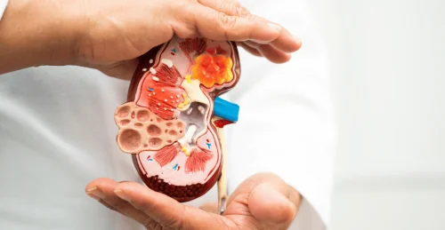 10 Tanda Penyakit Ginjal yang Sering Tak Disadari, Termasuk Urine Berbusa