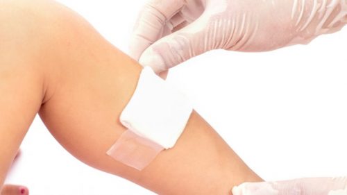 mempercepat penyembuhan luka