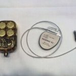 Pakai Alat Pacu Jantung? Jangan Simpan Ponsel di Sisi Saku Baju yang Salah