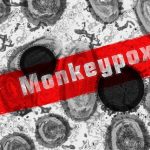 WHO: Monkeypox Hadirkan Risiko Sedang Terhadap Kesehatan Masyarakat