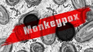WHO: Monkeypox Hadirkan Risiko Sedang Terhadap Kesehatan Masyarakat