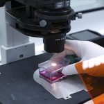 CDC Nigeria Konfirmasi 21 Kasus Cacar Monyet Tahun Ini