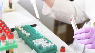 Kasus Cacar Monyet di Inggris Naik Menjadi 179