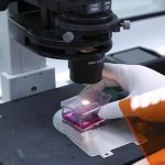 Badan Kesehatan Uni Eropa Sebut Cacar Monyet tak Mudah Menyebar