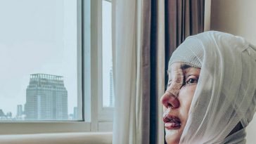 Mengenal Metode Operasi 'Ganti Kulit' Seperti yang akan Dilakukan Lucinta Luna