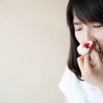 Jangan Panik, Ini 5 Cara Hentikan Mimisan Sesegera Mungkin