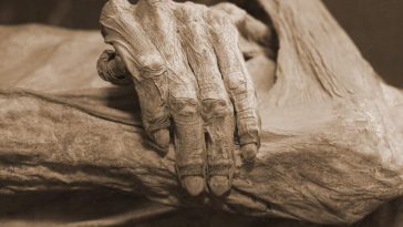 Tak Hanya Hamil, Mumi Misterius Ini Ternyata Juga Mengidap Kanker
