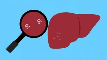 Indonesia Catat Dugaan Hepatitis Akut Bertambah Jadi 70 Kasus