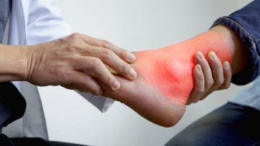 Asam Urat Sering Kambuh, Risiko Serangan Jantung dan Strok Makin Tinggi