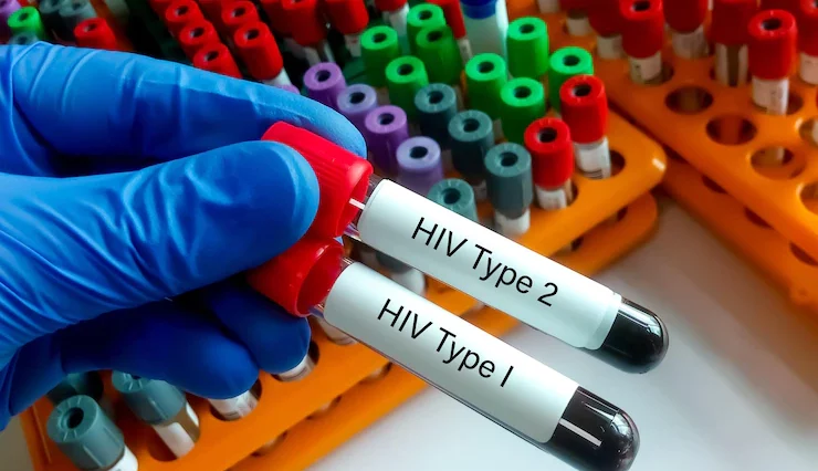 UNICEF: 110 Ribu Anak-Remaja Meninggal Akibat AIDS pada 2021