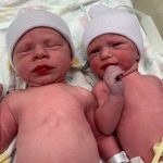 Bayi Kembar Ini Lahir dari Embrio yang Dibekukan 30 tahun lalu; Cetak Rekor Baru!