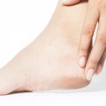 5 Tips Mengurangi Risiko Tumit Pecah-Pecah