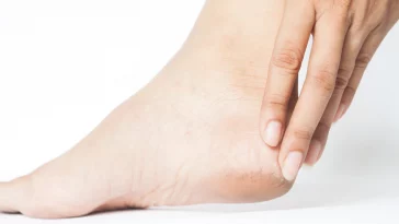 5 Tips Mengurangi Risiko Tumit Pecah-Pecah