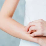 Tujuh Bahan Alami yang Bisa Bantu Memutihkan Kulit Tangan