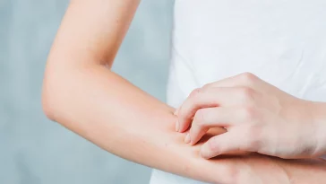 Tujuh Bahan Alami yang Bisa Bantu Memutihkan Kulit Tangan
