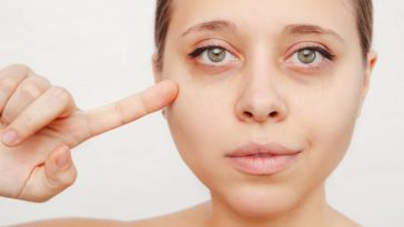 10 Cara hilangkan Mata Panda dengan Aman dan Mudah!