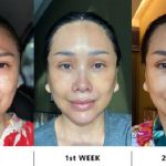 5 Jenis Operasi Plastik yang Dijalani Titi DJ untuk Tampil Lebih Muda