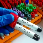 Waspada, Kelompok Gay Masih Dominasi Kasus HIV di Depok