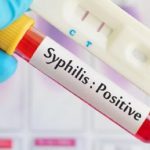 Kasus Sifilis Naik, Kemenkes Ingatkan Risiko Tertular HIV