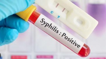 Kasus Sifilis Naik, Kemenkes Ingatkan Risiko Tertular HIV