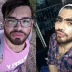 Terobsesi Mirip Ricky Martin, Pria Ini Nekat Suntikkan Oli Motor ke Wajahnya