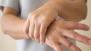 Benarkah Asam Urat bisa Sebabkan Kematian?