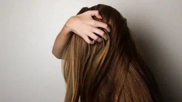 5 Cara Atasi Ketombe Basah, Sudah Pernah Coba?