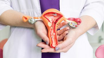 10 Benda Aneh yang di Temukan Dokter Obgyn dalam Organ Reproduksi Wanita