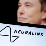 Neuralink, Perusahaan Elon Musk Ini Cari Sukarelawan Uji Coba Penanaman Chip pada Otak Manusia
