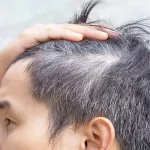 Mengapa Rambut yang Memutih Tidak Bisa Kembali Hitam?
