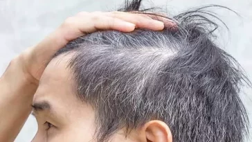 Mengapa Rambut yang Memutih Tidak Bisa Kembali Hitam?
