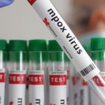 8 Gejala Virus Mpox atau Cacar Monyet Menurut WHO, yang Kini Mulai Mewabah di Indonesia!