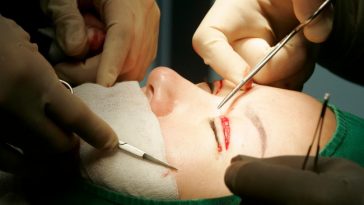 7 Daftar Negara yang Jadi Destinasi Wisata Medis untuk Operasi Plastik