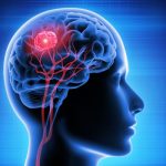 Waspadalah, Kedutan Ternyata Bisa Jadi Gejala Kanker dan Tumor Otak