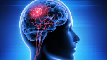 Waspadalah, Kedutan Ternyata Bisa Jadi Gejala Kanker dan Tumor Otak