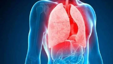 5 Fakta Kasus TBC di Indonesia yang Jadi Peringkat Ke-2 Terbanyak di Dunia