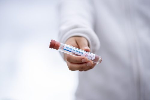 Kasus Aktif COVID-19 di India Tembus 6.000, 65 Meninggal