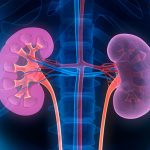 Kenali Gejala Kanker Ginjal Stadium Awal hingga Akhir