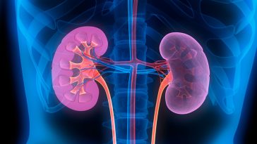 Kenali Gejala Kanker Ginjal Stadium Awal hingga Akhir