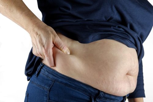 Ini 3 Cara Menghindari Kulit Bergelambir saat Menurunkan Berat Badan