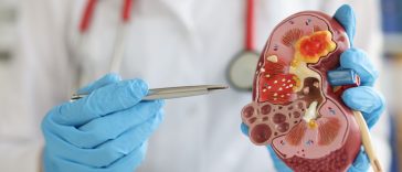 Inilah Ciri-ciri Penyakit Batu Ginjal yang Perlu Diwaspadai