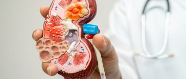 5 Tanda Tersembunyi Penyakit GinjaL yang Jarang Disadari, Apa Saja?