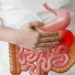 5 Kebiasaan Ini Bisa Picu Usus Buntu, Sepele tapi Bikin Sakit