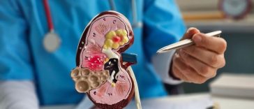 Tanpa Disadari, 5 Kebiasaan Sepele Ini Bisa Picu Batu Ginjal