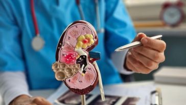 Tanpa Disadari, 5 Kebiasaan Sepele Ini Bisa Picu Batu Ginjal