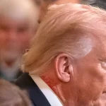 Ruam Merah di Leher Donald Trump Jadi Sorotan, Ini Penjelasan Dokter Kepresidenan AS