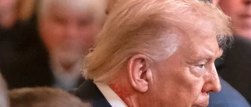 Ruam Merah di Leher Donald Trump Jadi Sorotan, Ini Penjelasan Dokter Kepresidenan AS