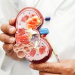 Gejala Kanker Ginjal: Dari Darah di Urine hingga Nyeri Pinggang