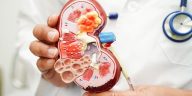 Gejala Kanker Ginjal: Dari Darah di Urine hingga Nyeri Pinggang