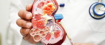 Gejala Kanker Ginjal: Dari Darah di Urine hingga Nyeri Pinggang